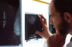 W czasie urlopu choroba zaatakowała płuca które ogląda lekarz pod rentgenem